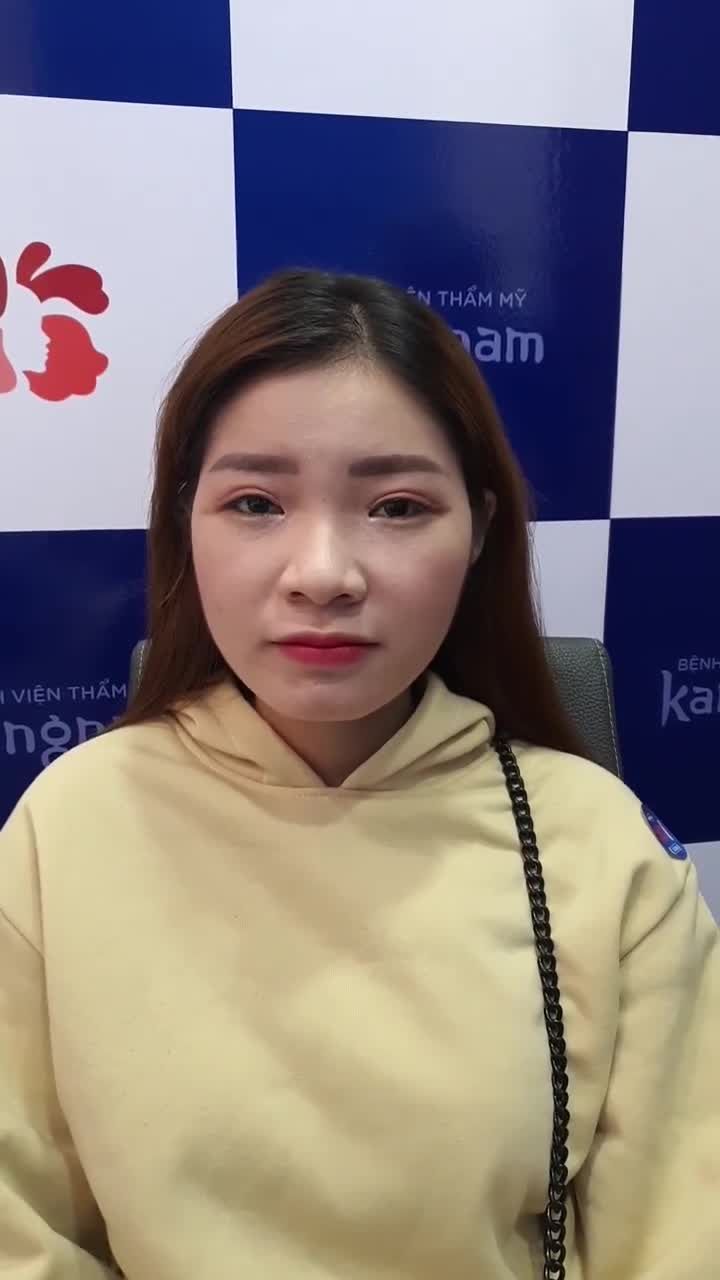 Mắt 1 mí có da dư Chọn Bấm mí hay Cắt mí?