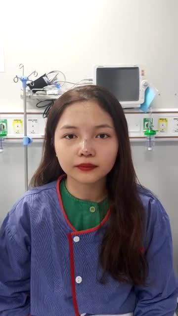 Nâng mũi cấu trúc 4D Mũi mới 60 phút tiểu phẫu đã khiến khách hàng thích mê