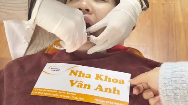 BUNG LỤA CHO KHÁCH HÀNG VI THỊ NHƯ QUỲNH  1993 RĂNG HÔ