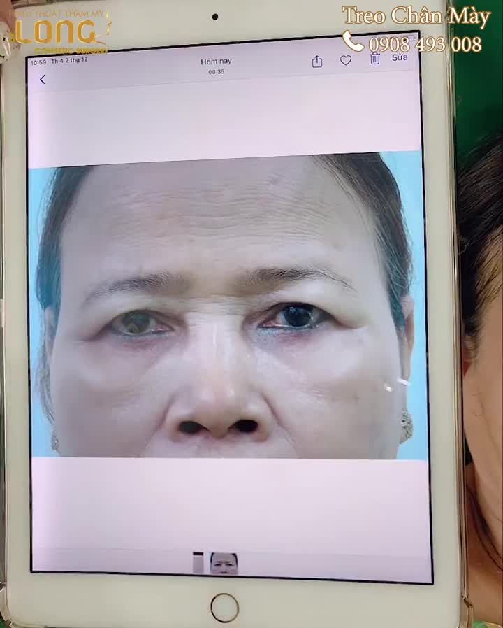 Treo chân mày có ngay đôi mắt đẹp