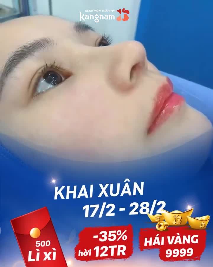 Khai xuân THỜI ĐIỂM NÂNG MŨI GIÁ TỐT NHẤT