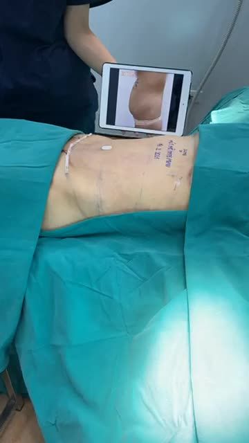 BIẾN ĐỔI BODY “NGON” NHƯ GÁI CÒN SON CHO BÀ MẸ 3 CON