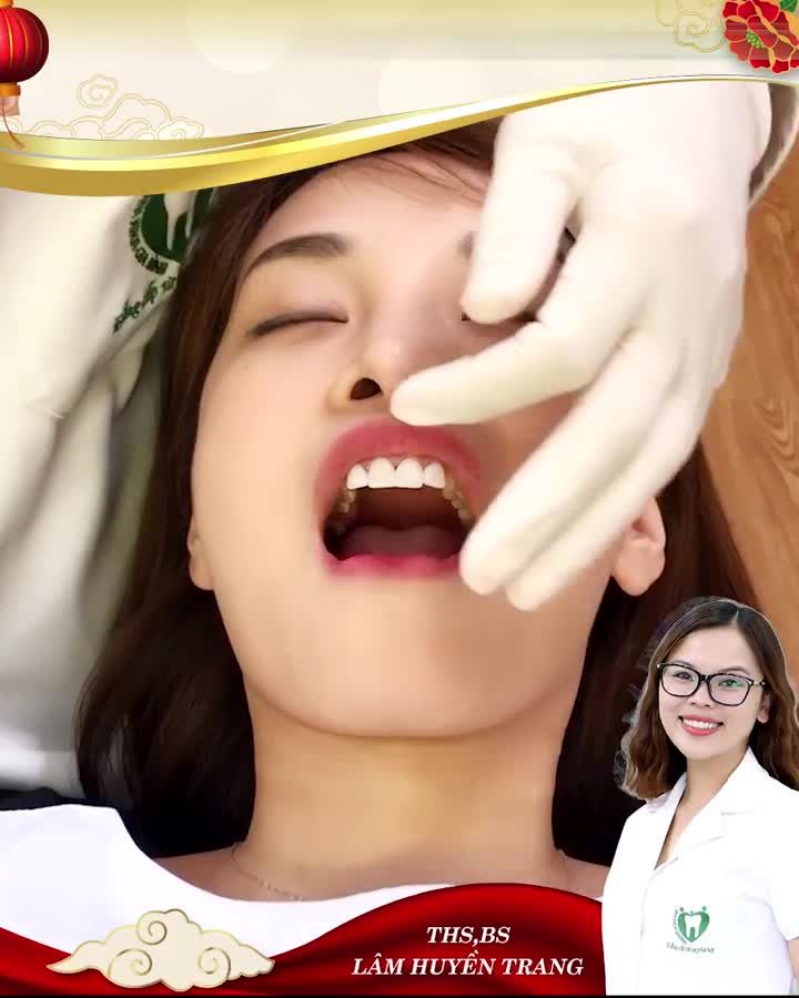 Cảm lạnh có thể do gió nhưng cảm nắng chắc chắn là do nụ cười em