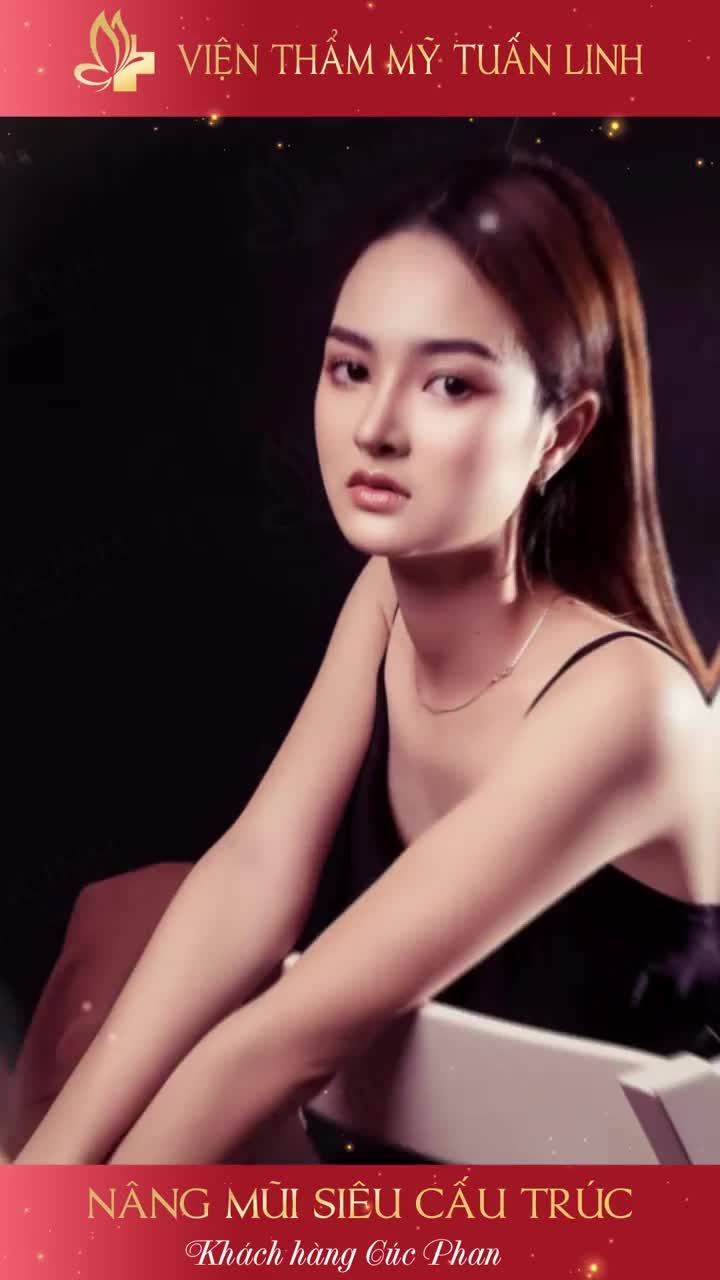 "CÔNG VIỆC THUẬN LỢI HƠN SAU KHI EM NÂNG MŨI" Chia sẻ của cô nàng chuyên viên spa, khách hàng nhà Tuấn Linh.
