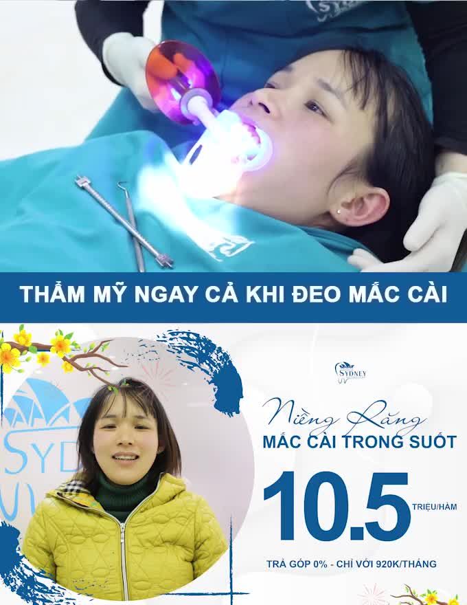 NIỀNG RĂNG XINH LUNG LINH ĐÓN TẾT