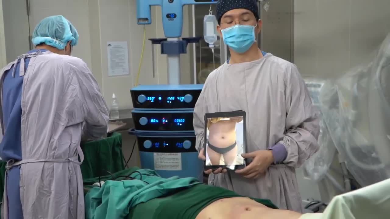 VASER LIPO POWER X: TRÚT SẠCH MỠ THỪA  EO THON ĐÓN TẾT