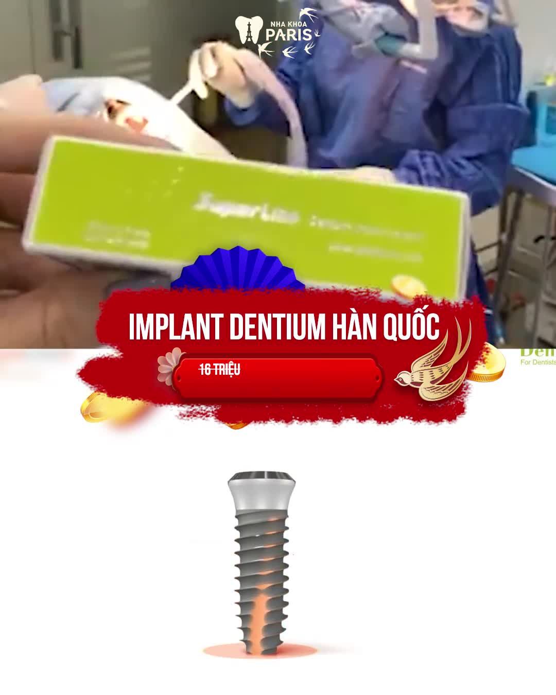 KHAI XUÂN TRỒNG RĂNG SALE CỰC ĐÃ