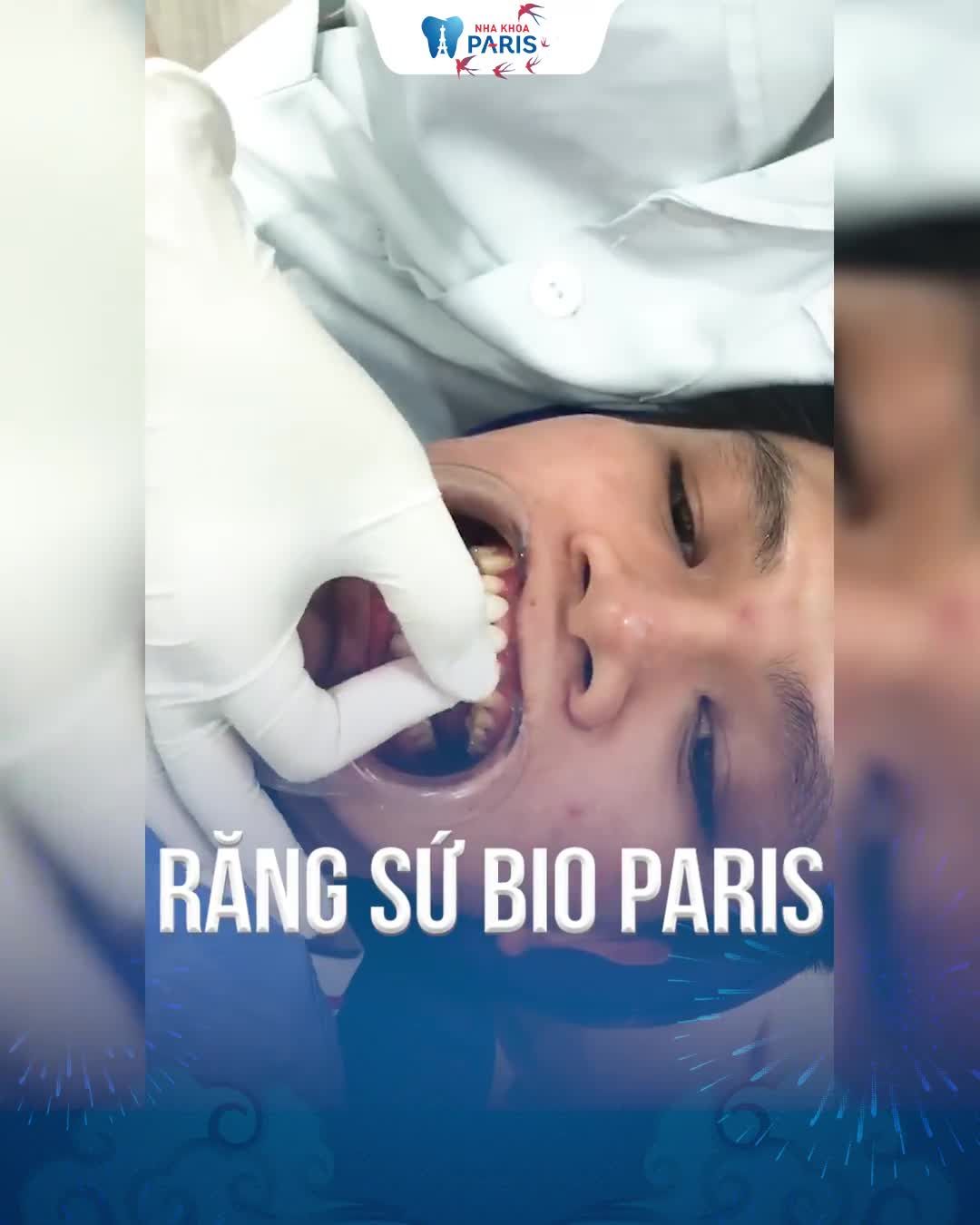 "Phá Giá" Bọc Sứ Khai Xuân Tưng Bừng