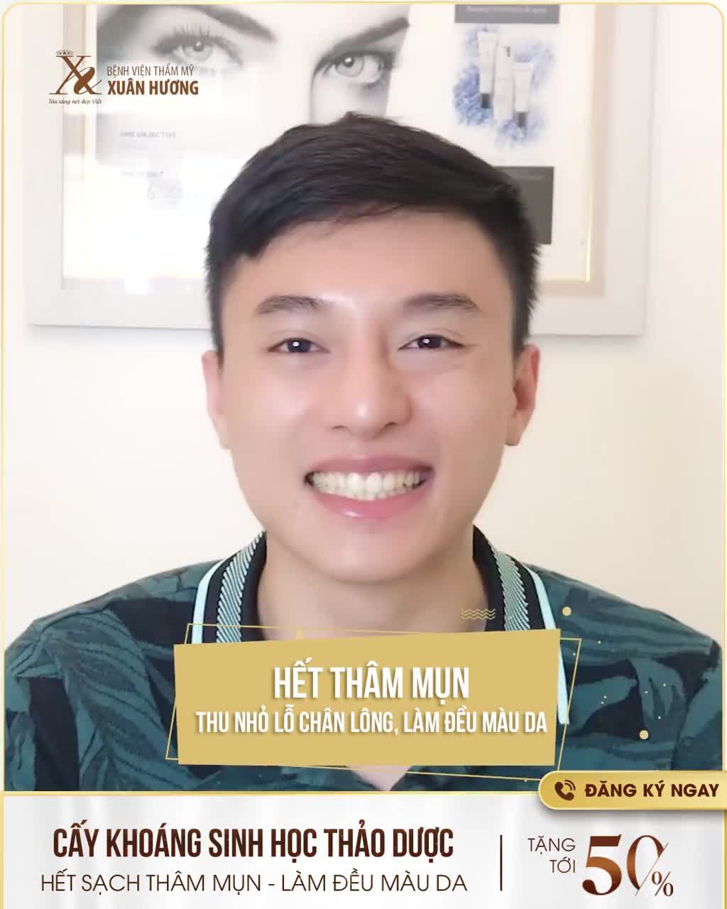 CHỈ 01 BUỔI THỰC HIỆN CẢI THIỆN TỚI 80% TÌNH TRẠNG DA THÂM MỤN