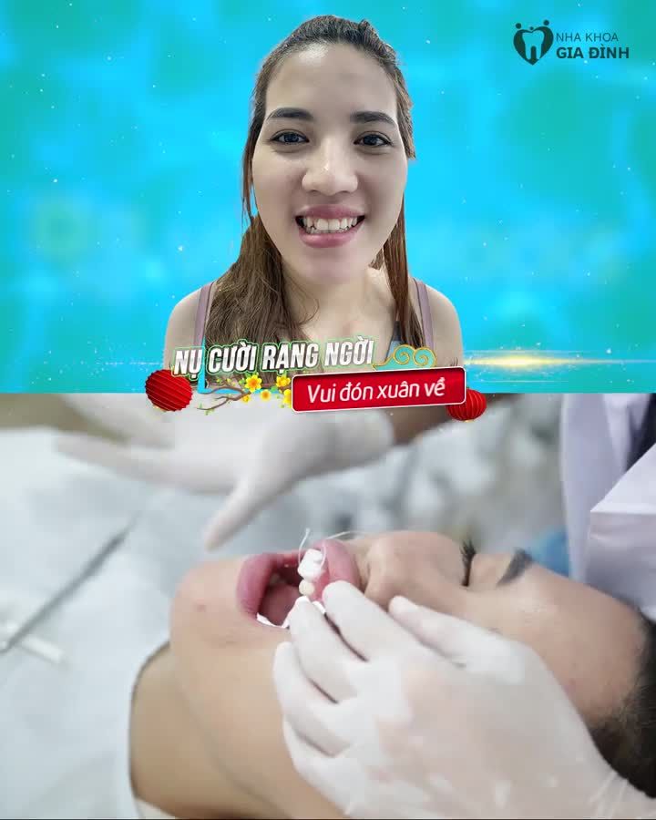 RĂNG TRẮNG RẠNG NGỜI TƯƠI XINH ĐÓN TẾT