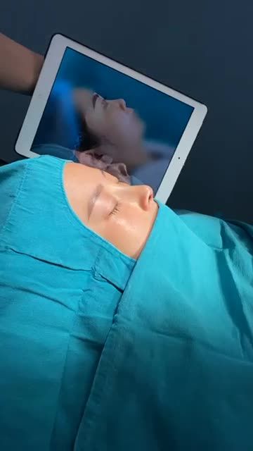 45P NÂNG MŨI ĐỔI VẬN, "XOÁ SỔ" MŨI THẤP TẸT
