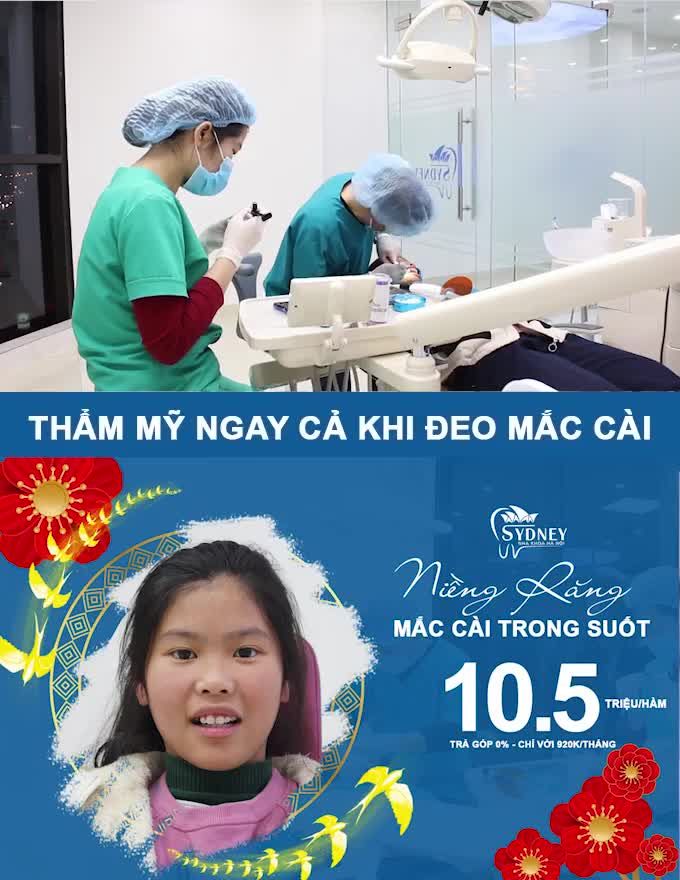NIỀNG RĂNG MẮC CÀI PHA LÊ TRONG SUỐT