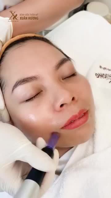 PHỤC HỒI DA CẤP TỐC KỊP ĐÓN TẾT VỚI LÀN DA CĂNG MỊN NHỜ ĐƯA DƯỠNG CHẤT TẠI BVTM XUÂN HƯƠNG