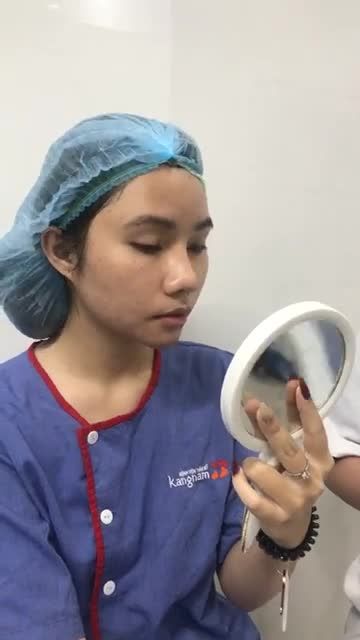 Cải thiện Cằm ngắn  Đón cằm Vline sau 30 phút ĐỘN CẰM