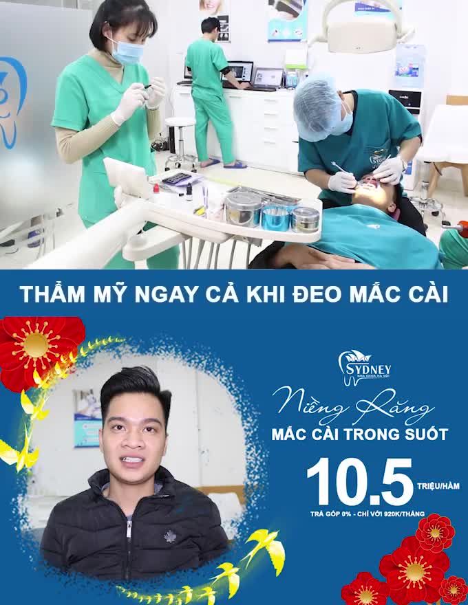 NIỀNG RĂNG MẮC CÀI PHA LÊ CHỈ 10.5TR/HÀM