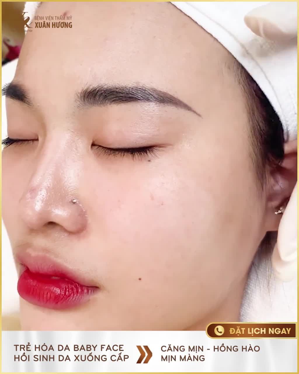 ĐẾM NGƯỢC 5 NGÀY ĐẾN TẾT VẪN KỊP ĐỂ BẠN SỞ HỮU DA ĐẸP DU XUÂN CÙNG BABY FACE