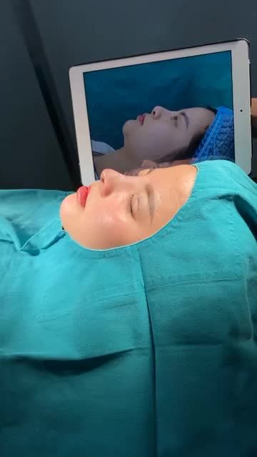ƯU ĐÃI TÂN XUÂN NÂNG MŨI ĐẸP CHUẨN