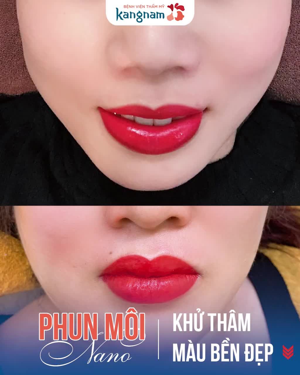 "Biến hình" MÔI THÂM thành MÔI HỒNG MỌNG MƯỚT