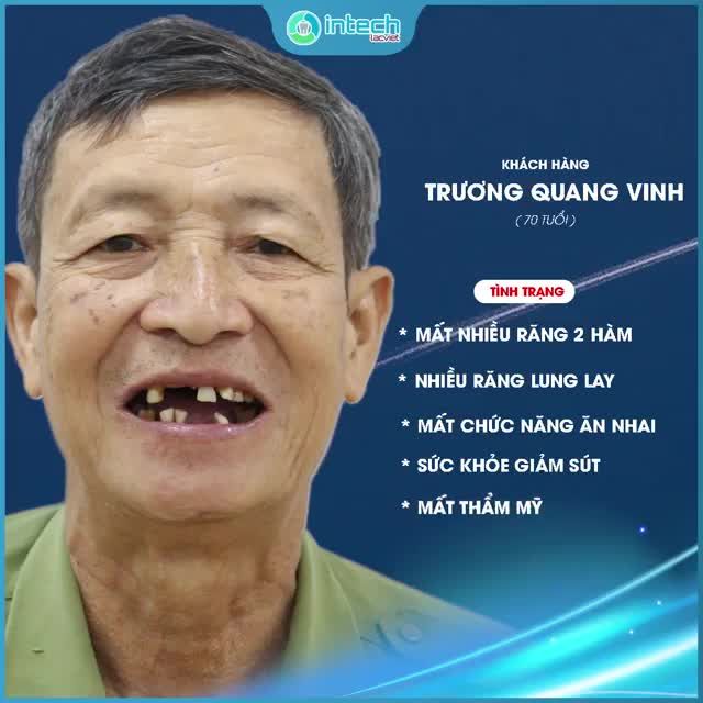 CẢI THIỆN CHẤT LƯỢNG CUỘC SỐNG SAU KHI TRỒNG RĂNG IMPLANT