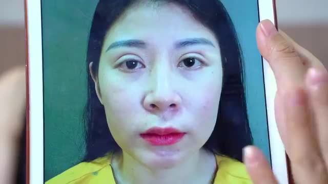 Cận cảnh ca giải cứu mí lỗi, hỏng do từng cắt mí tại cơ sở kém uy tín trước đó và đừng bỏ lỡ dáng mũi đẹp "không góc chết" sau 3 năm nâng mũi tại Dr.Hải Lê của bạn gái ngay sau đây nha!