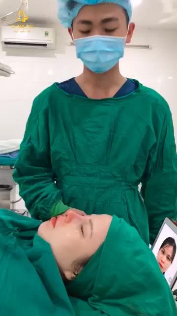 Case: NÂNG MŨI CẤU TRÚC SỤN SURGIFORM SAU 90 PHÚT PHẪU THUẬT.