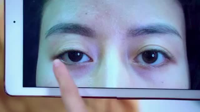 Cắt mí hỏng tại cơ sở kém uy tín và cuộc "giải cứu" mí lỗi, hỏng thành công tại Dr.Hải Lê. 10 người xem thì chắc chắn có tới 9 người ồ lên vì ngạc nhiên