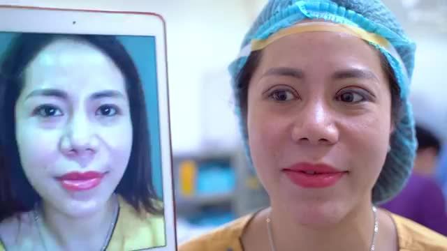 Cắt mí thường đẹp đã khó nhưng xử lí những ca mí siêu khó mà vẫn đảm bảo yếu tố đẹp và an toàn thì không phải ở đâu cũng làm được.