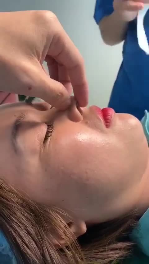 Chào ngày mới với ca Nâng mũi cấu trúc
