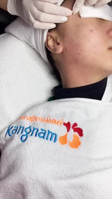 Đã mắt với quy trình NẶN MỤN tại Kangnam