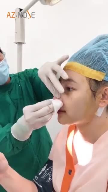 Dáng mũi Sline cao tự nhiên do bác sĩ Sơn Tùng thực hiện