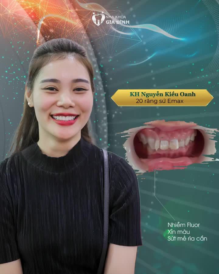 ĐẦU TƯ CHO NHAN SẮC TRẺ TRUNG QUÊN THỜI GIAN
