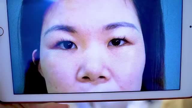 Đôi mắt là cửa sổ tâm hồn Nếu nó có khuyết điểm hãy giúp đôi mắt của bạn đẹp lên nhờ Cắt mí thẩm mỹ bạn nhé