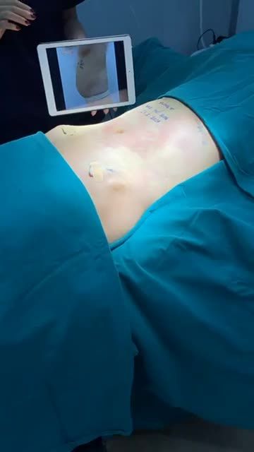 EO "THÙNG PHI" THON GỌN TỨC THÌ