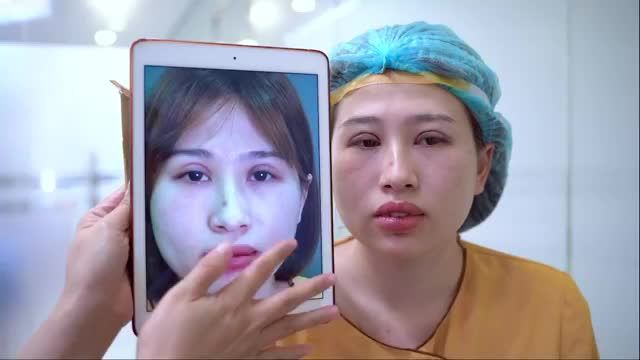 GIẢI CỨU THÀNH CÔNG CA MÍ LỖI HỎNG ĐỘ 3 SAU KHI THỰC HIỆN TẠI CƠ SỞ KÉM CHẤT LƯỢNG, THIẾU UY TÍN