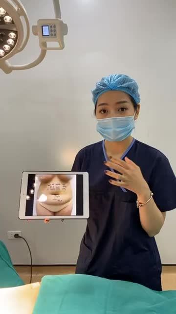 HÚT SẠCH MỠ THỪA MẶC GÌ CŨNG VỪA