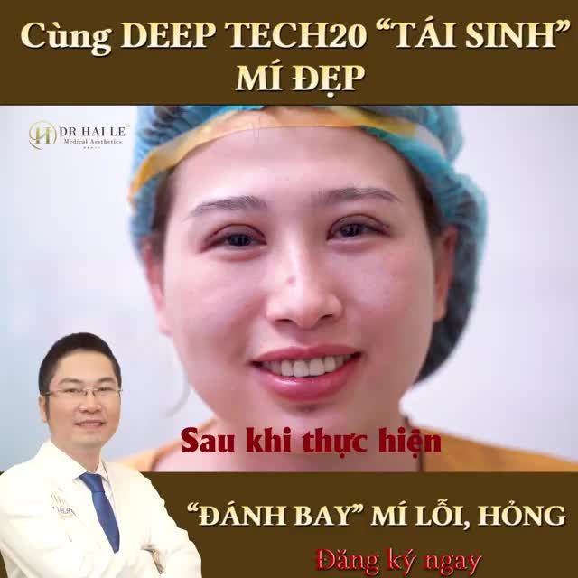 “Không may bị thẩm mỹ lỗi hỏng 1 lần, đến sửa em thấy cũng rất sợ, chỉ từ khi biết đến Dr.Hải Lê sự lo lắng của em mới được giải quyết”