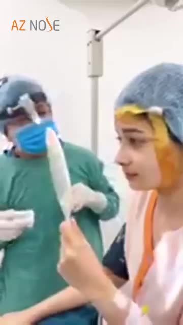 Mũi Sline tự nhiên thay đổi 90% diện mạo