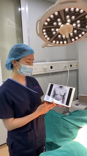 NÂNG CẤP VÒNG 1 BỞI EKIP SLINE- NÂNG LÀ ĐẸP, DẸP TRIỆT ĐỂ TEO LÉP