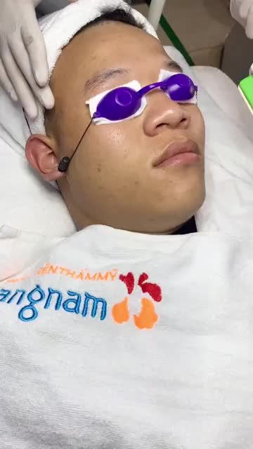 Sạch bay MỤN chỉ sau 1 liệu trình chuyên sâu De Ance