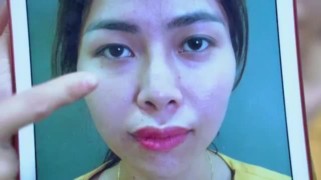 Tại sao bạn nên can thiệp chỉnh hình mí mắt sớm khi có dấu hiệu lão hóa da mí gây sụp mí?
