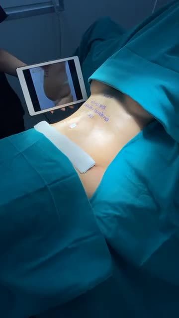 VÒNG 2 THON GỌN  ĐÓN TRỌN NIỀM VUI