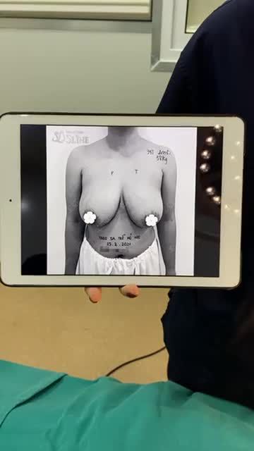 "XOÁ BỎ" VÒNG 1 QUÁ KHỔ CHO BÀ MẸ 2 CON