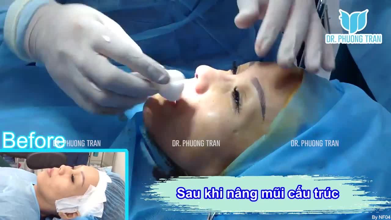1 CHỮ “ĐẸP” CỦA BẠN LÀM TÔI VUI CẢ NGÀY