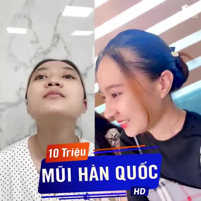 10 TRIỆU NÂNG MŨI HÀN QUỐC MŨI CAO ĐẸP MỌI GÓC ĐỘ
