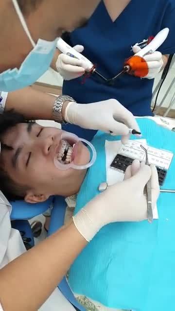 Bạn đang gặp các tình trạng về răng: Răng xô lệch, khấp khểnh Hàm hô móm, phát triển không đều Còn trẻ tuổi muốn cải thiện khớp cắn