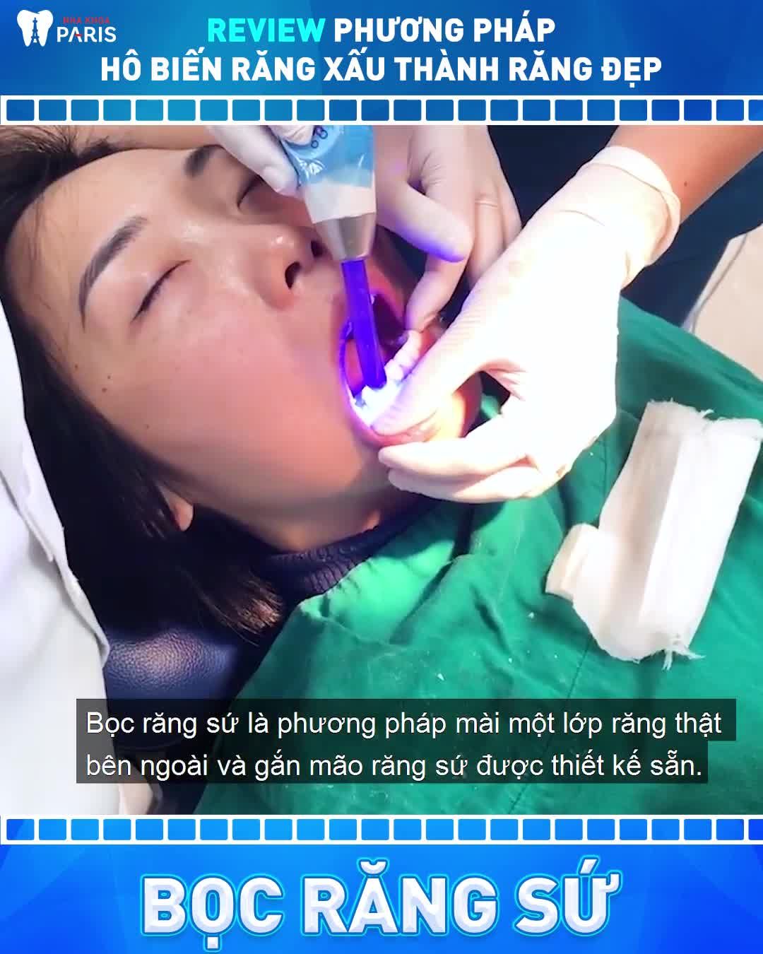 Bọc Răng Sứ Cười là Tự Tin, Duyên Dáng