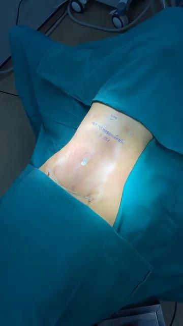 BỤNG HẾT SỒ SỀ  ĐẸP MÊ MIỄN CHÊ