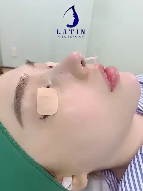 CA MŨI CẤU TRÚC LATIN VỪA RA LÒ, ĐẦU MŨI TRÒN PHONG THUỶ