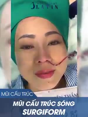 CA MŨI CẤU TRÚC SỤN SURGIFORM