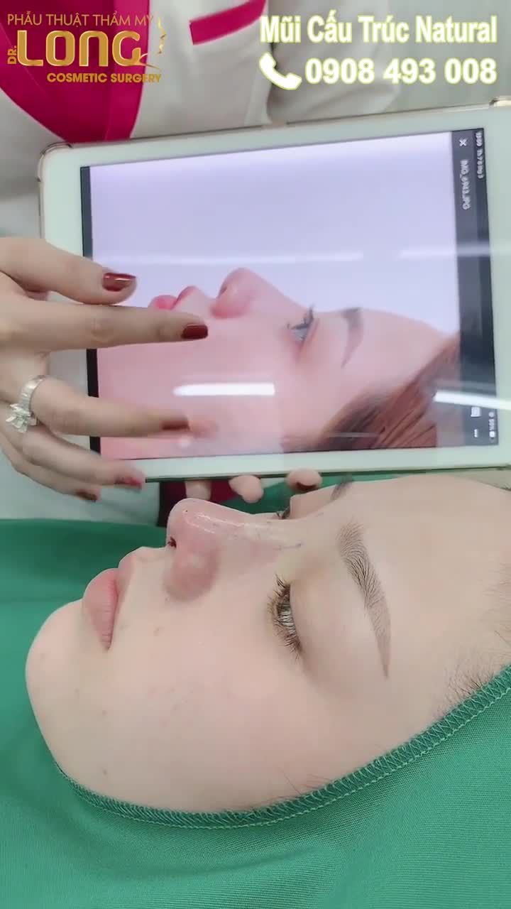 CA NÂNG MŨI SỬA LẠI